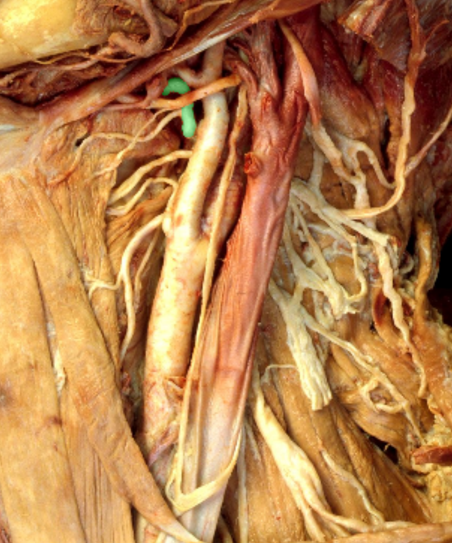 <p>Which artery?</p>