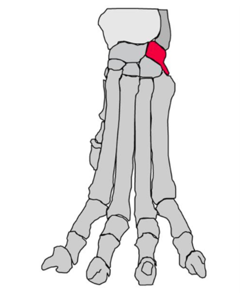 <p>located laterally, articulates with ulna</p>