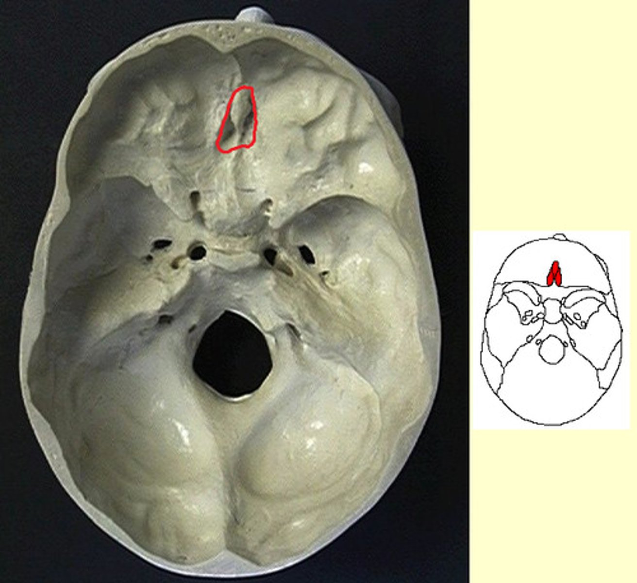 knowt flashcard image