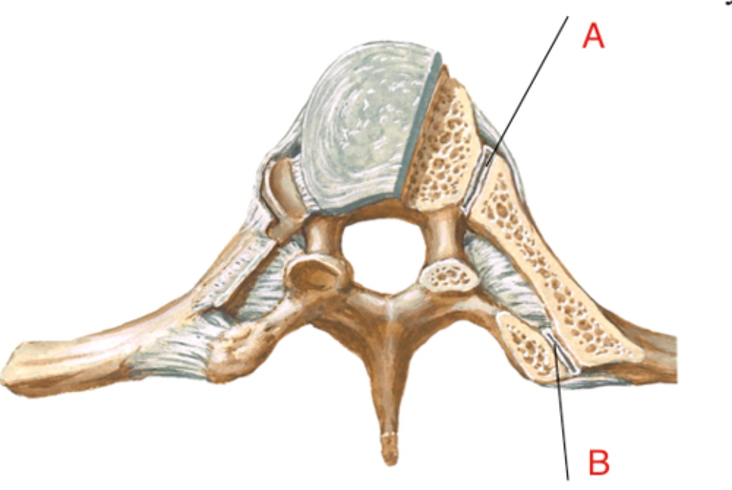 <p>superior and inferior costal facets of the body of thoracic vertebrae articulation with the head of the rib (A on image)</p>
