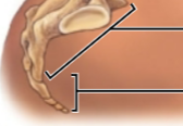 <p>This is the <strong>fourth&nbsp;and&nbsp;last&nbsp;</strong>of the spinal curves / vertebrate regions. What is this region called?</p>