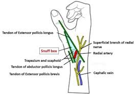 <p>"Distal radial artery access involves access to the radial artery in the region of the anatomic snuffbox.&nbsp;</p>