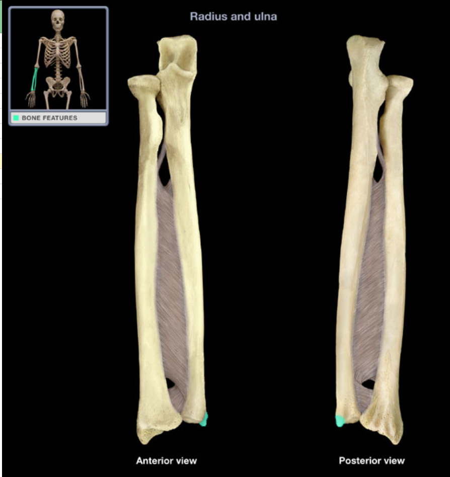 <p>Provides attachment for muscle, stabilizes wrist</p>