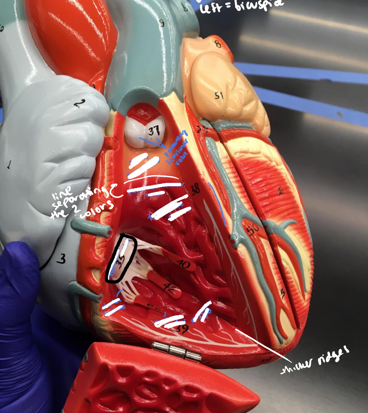 <p>The valve with 3 papillary muscle connections</p>