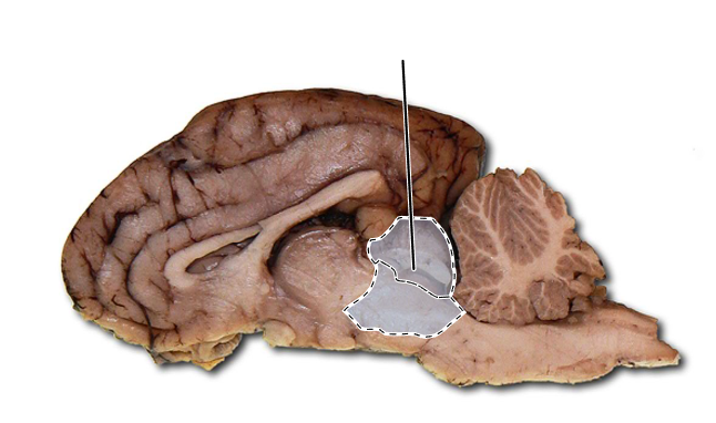 <p>Name the highlighted part of the brain.</p>