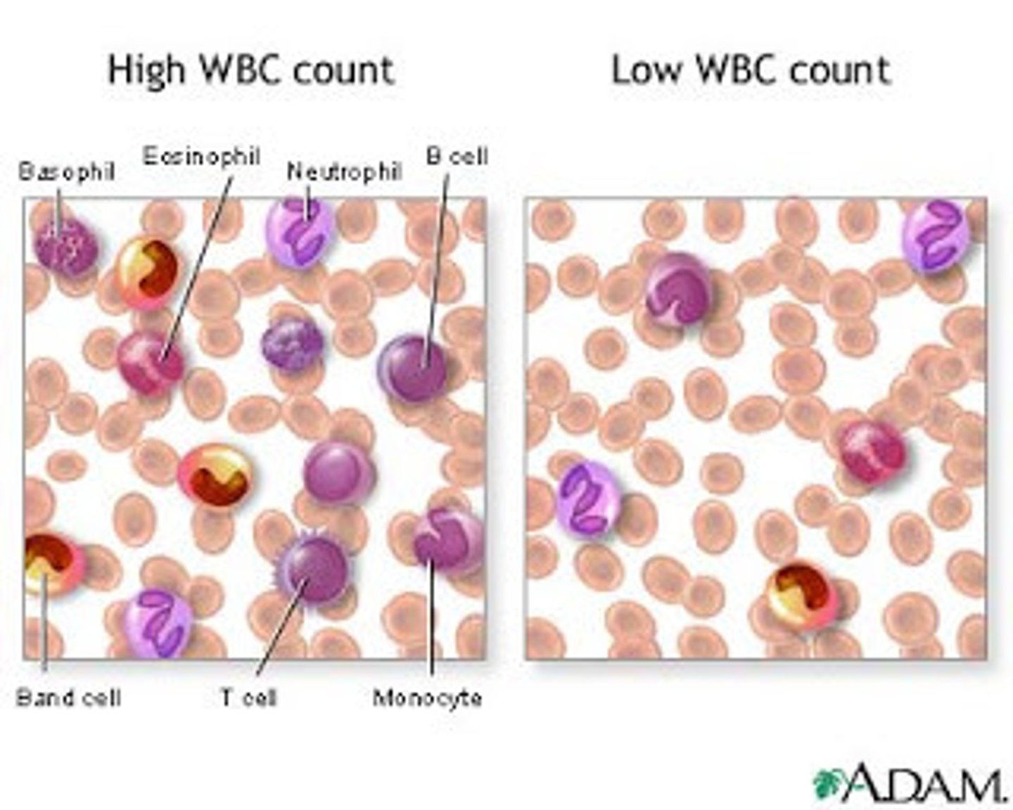 <p>Abnormally low white blood cell count</p>