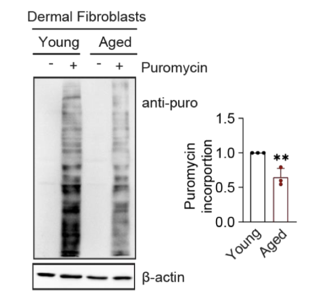 <p><span style="background-color: inherit; line-height: 22px; color: windowtext;"><span>Toxin that binds to new proteins from ribosome- tells how many copies being translated</span></span><span style="line-height: 22px; color: windowtext;"><span> </span></span></p><ul><li><p class="Paragraph SCXO6433770 BCX0" style="text-align: left;"><span style="background-color: inherit; line-height: 22px; color: windowtext;"><span>Can see the rate of overall protein translation</span></span><span style="line-height: 22px; color: windowtext;"><span> </span></span></p></li><li><p>less protein labelled in old cells- rate of translation becomes slower</p></li></ul><p></p>