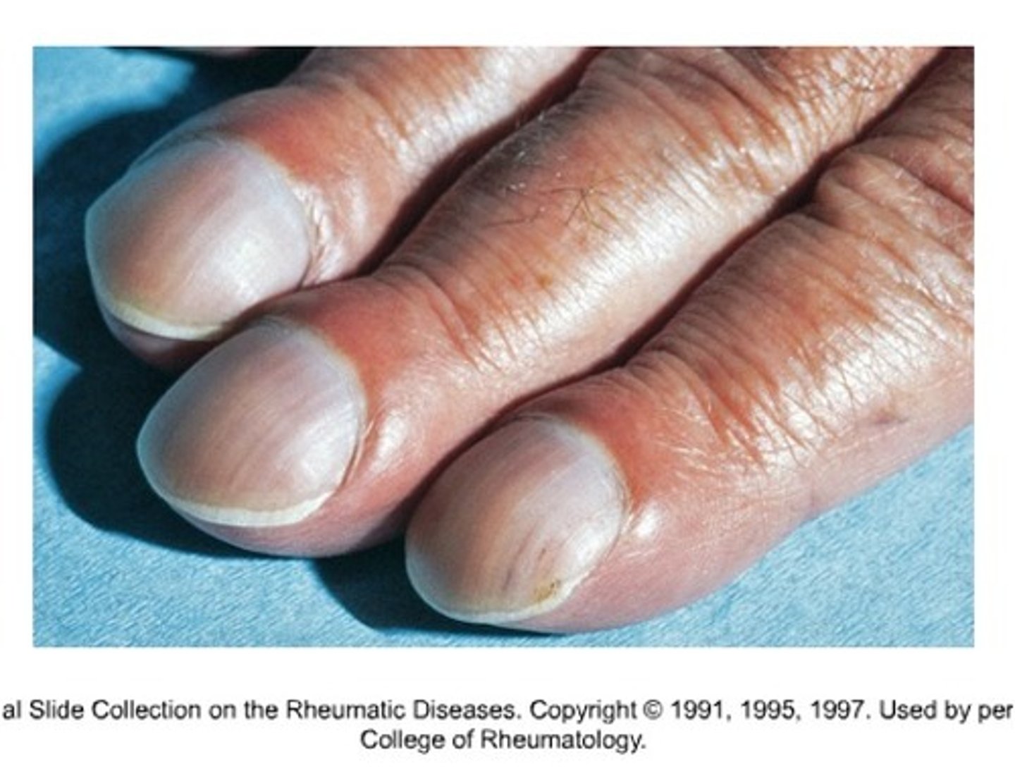 <p>nails should be (degrees)</p>
