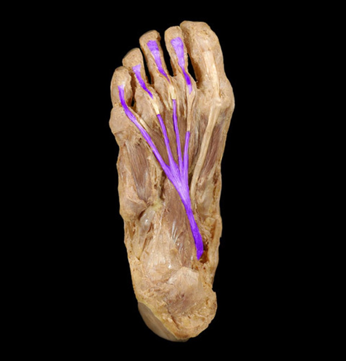 <p>Origin: Posterior tibia and fibula</p><p>Insertion: Distal phalanges 2-5</p>