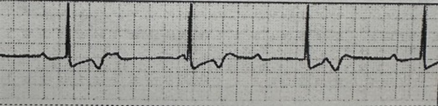 <p>identify the rhythm</p>