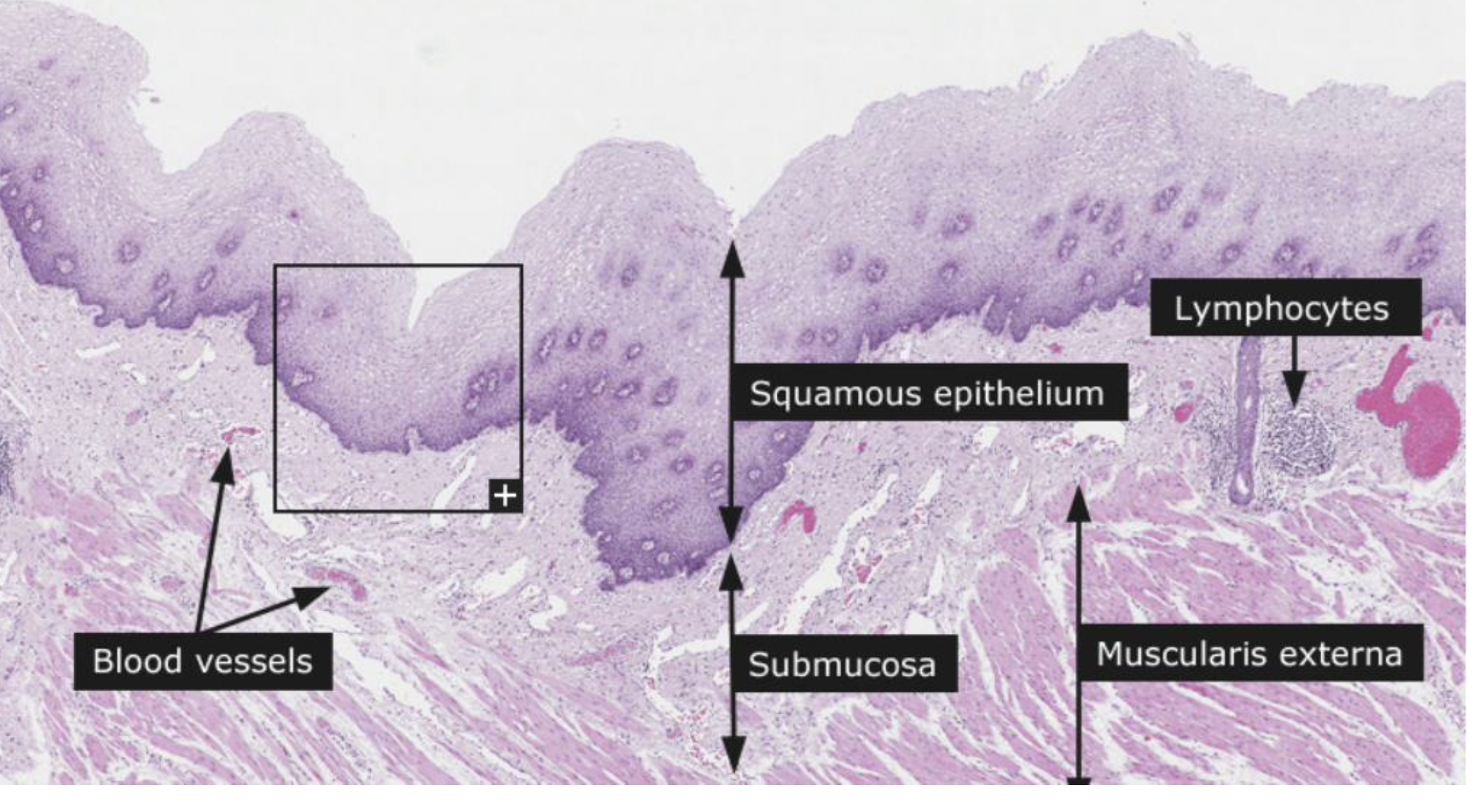 Yes, **an inner circular and outer longitudinal layer.**

* It is skeletal proximally and 

  in most species transitions to **smooth muscle** distally; (*note, it is all skeletal in dogs & ruminants* 

\
