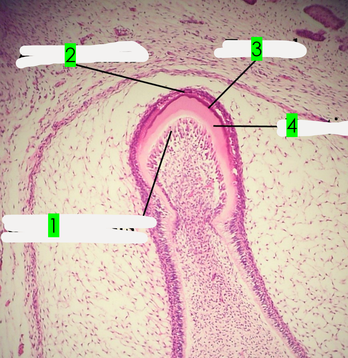 <p>What is arrow 2 pointing to?</p>