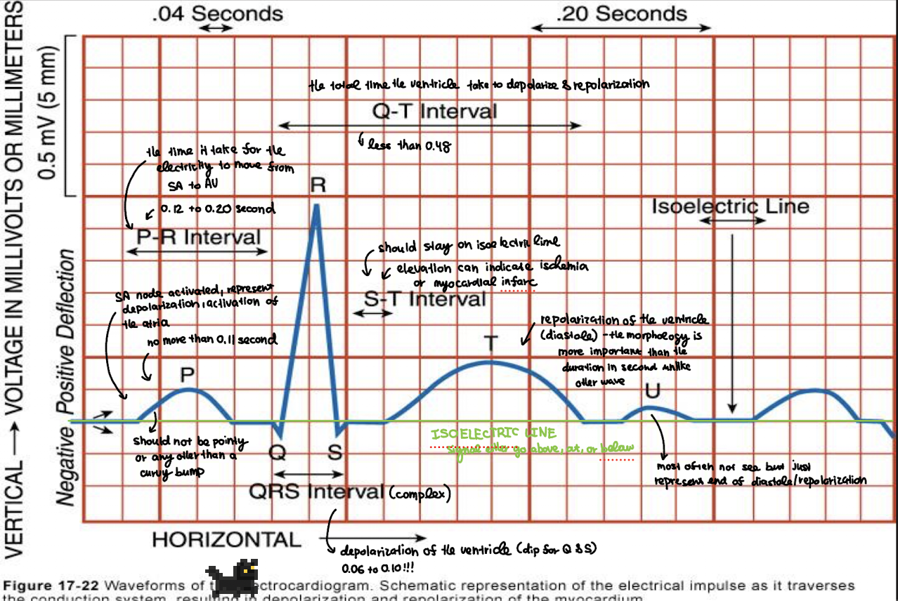 <p>the flat line between the end of the P wave and the start of QRS complex; represent the delay in the AV node before ventricular depolarization</p>