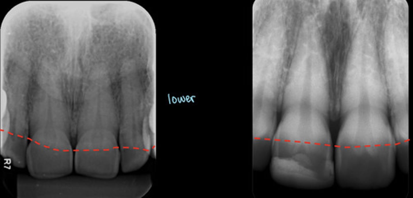 <p>What is the red dotted line representing?</p>