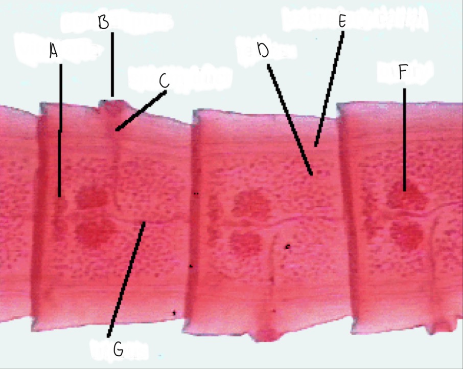 <p>What phyla and class does this organism belong to? Identify the parts that correspond to each letter.</p>