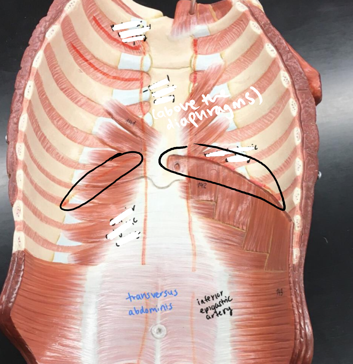 <p>Arches across the top of the diaphragm</p>