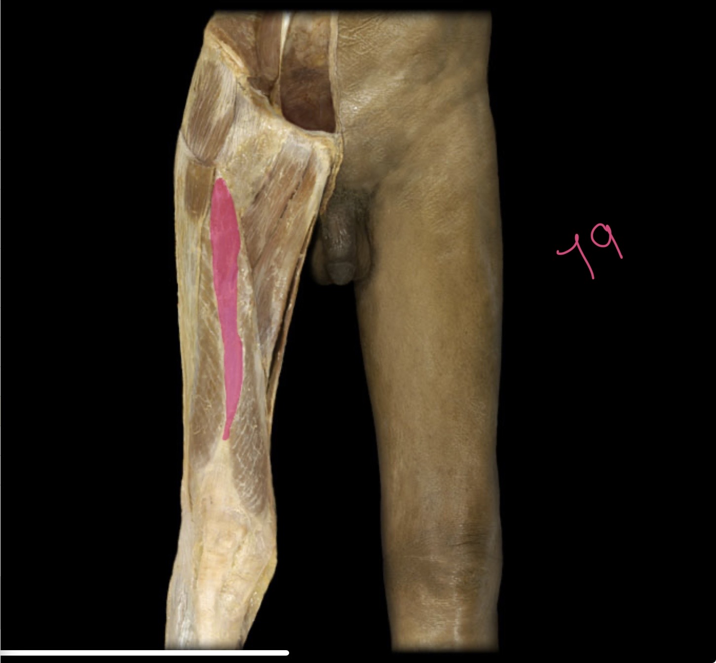 <p>Vastus liter medium</p>