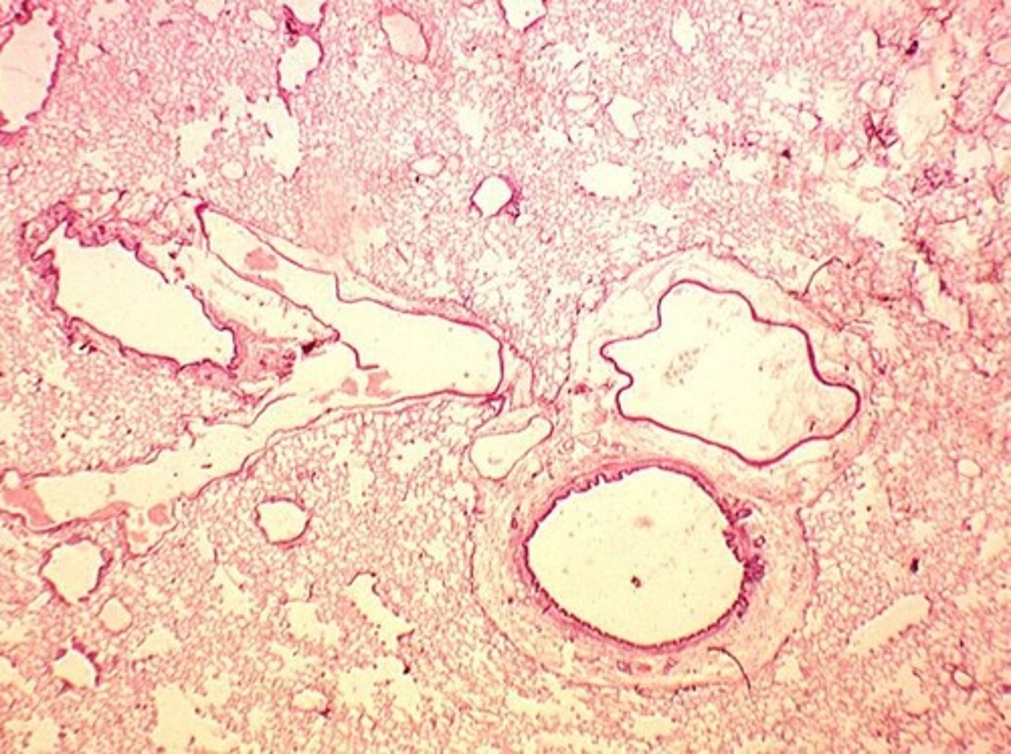 <p>Tiny air sacs in lungs for gas exchange.</p>