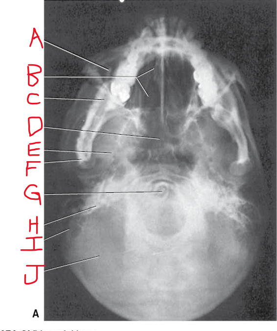 <p>D E &amp; F</p>