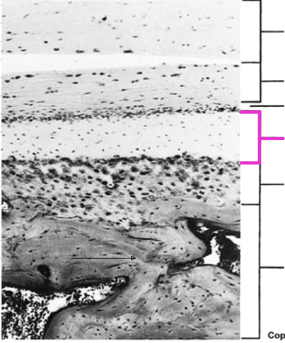<p>Identify the histological structure of the adult mandibular condyle</p>