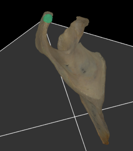 <p><span>articulatievlak op het acromion voor de clavicula</span></p>