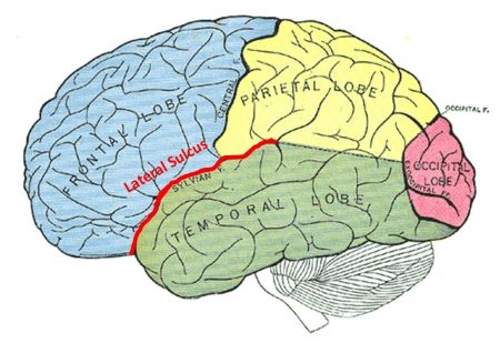 <p>Isolates <mark data-color="yellow" style="background-color: yellow; color: inherit;">temporal</mark> lobe from frontal and parietal lobes</p>