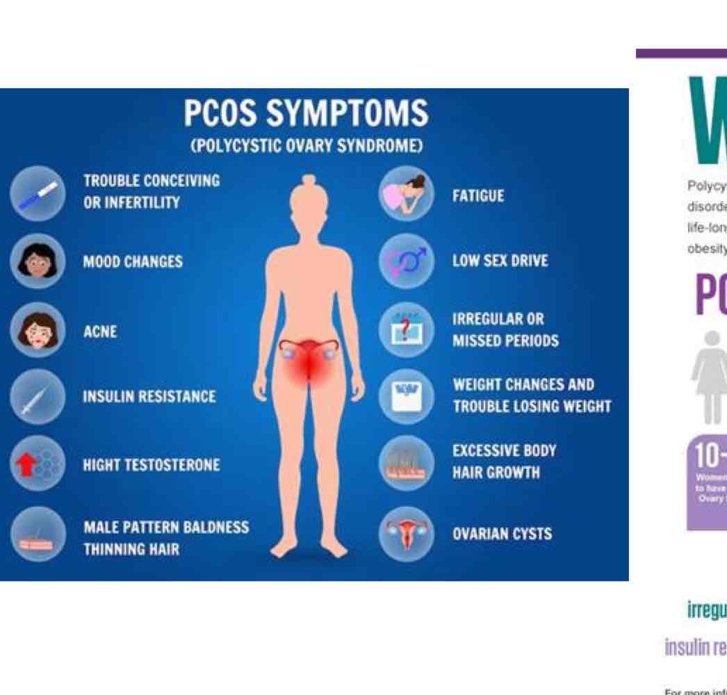 <ol><li><p>irregular periods</p></li><li><p>excess facial and body hair</p></li><li><p>severe acne</p></li><li><p>small cysts in ovaries</p></li><li><p>insulin resistance</p></li><li><p>anxiety and depression</p></li><li><p>infertility</p></li><li><p>wt gain</p></li><li><p>male pattern hair loss</p></li></ol>