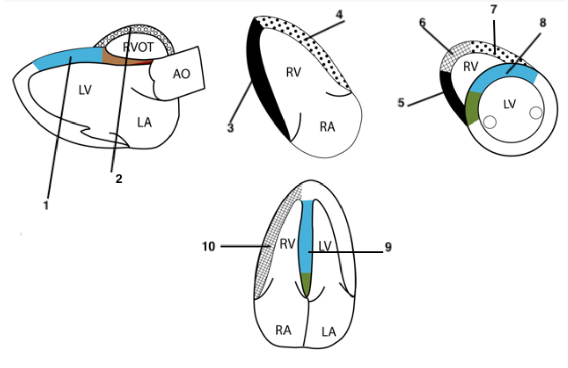 <p><span><span>Match the following numbers with the correspondent RV walls:</span></span></p>