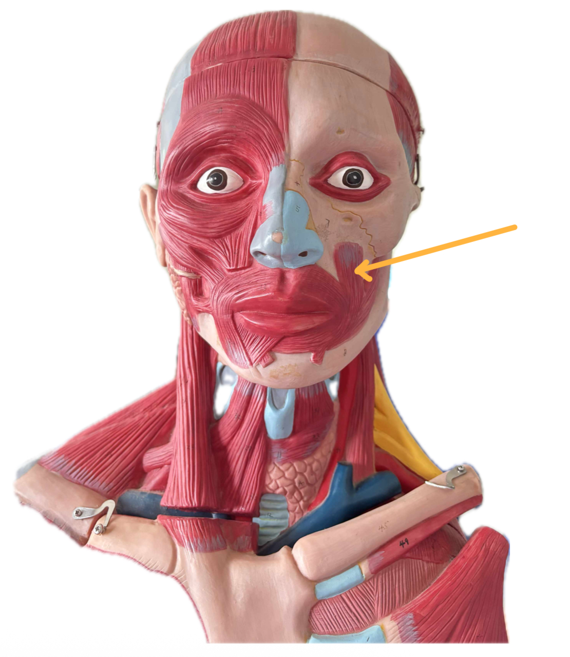 term image