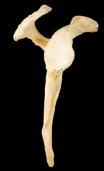 <p>Name this bone.</p><p>(Lateral view, right side).</p>