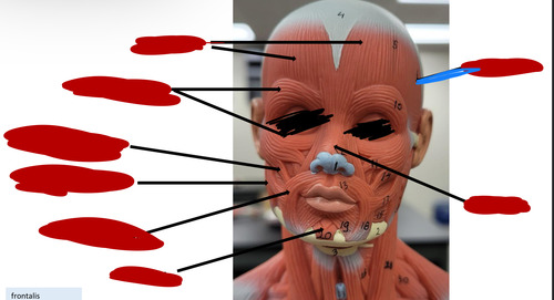<p>What muscle is this?</p>