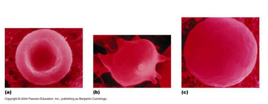 <p>Which red blood cell is under hypotonic conditions?</p>