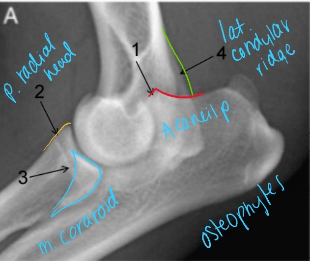 <p><span style="background-color: transparent;"><strong><span>Medial Compartment and Coronoid Disease</span></strong></span></p>