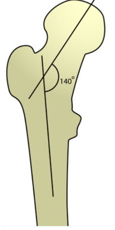 <p>&gt;135 degree</p>