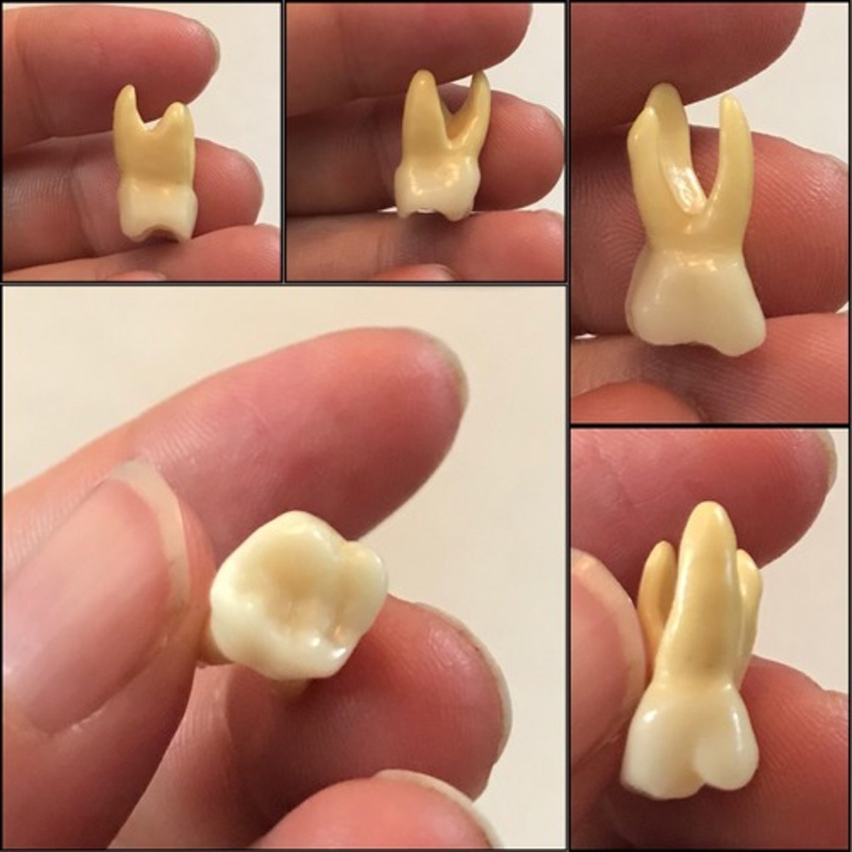 <p>What tooth is this ?</p>