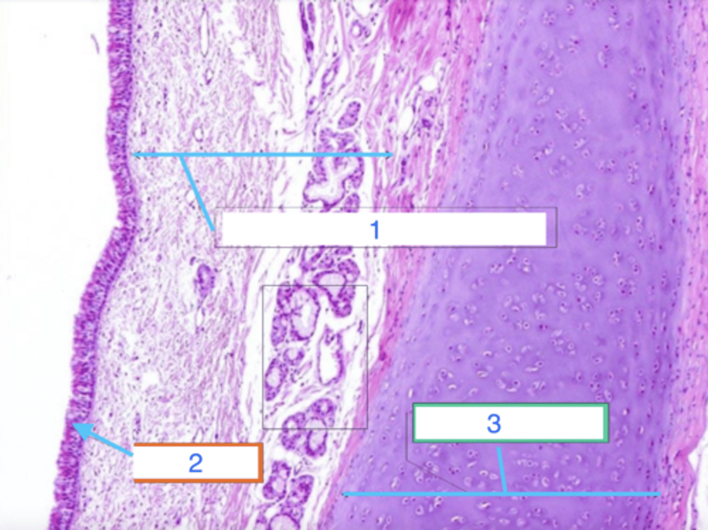 <p>what is 3?</p>