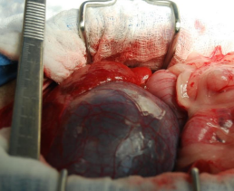 <p><span><strong>Surgical Techniques of the Gallbladder</strong></span></p>
