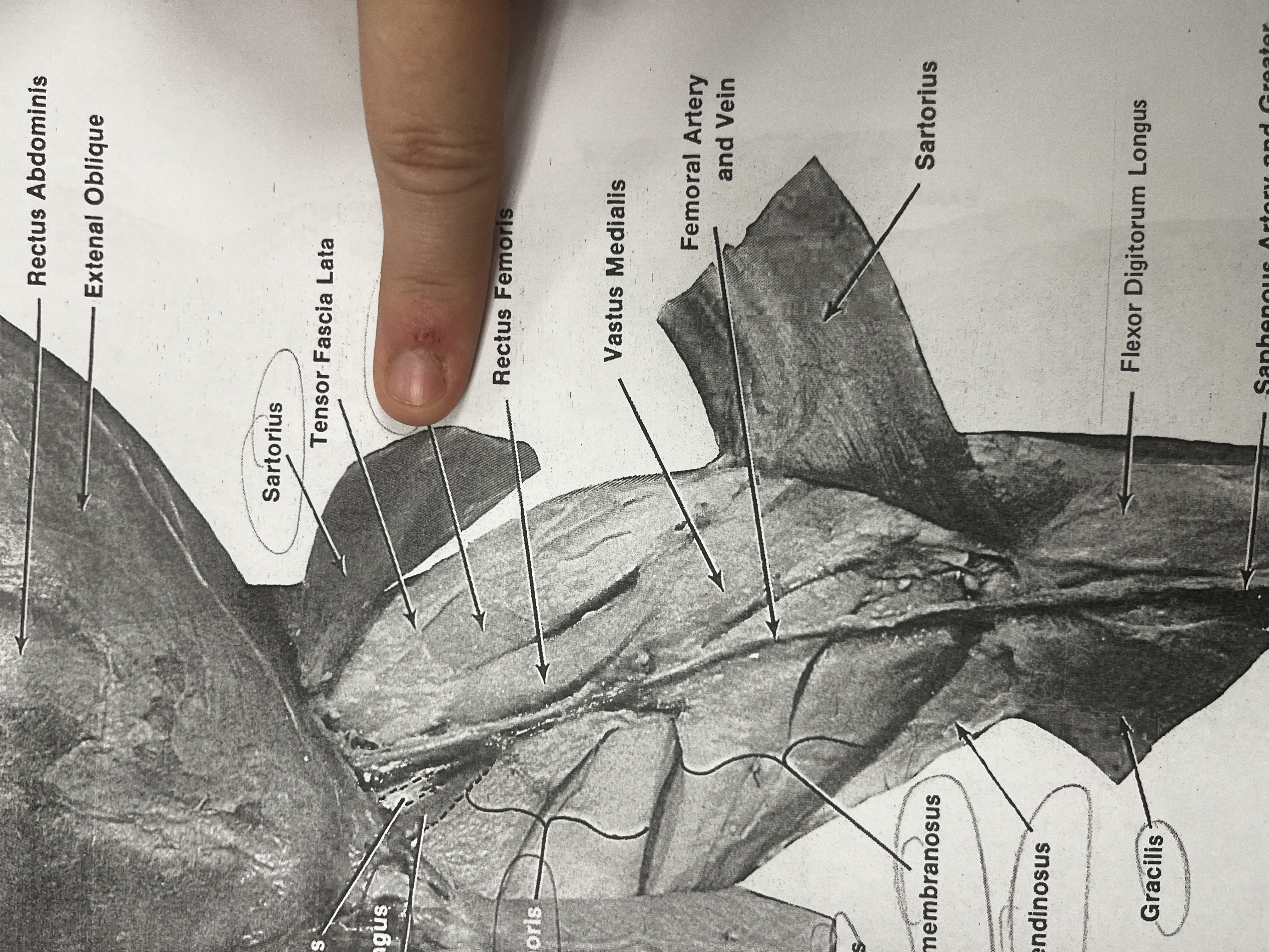 <p>A muscle of the quadriceps that helps extend the knee.</p>