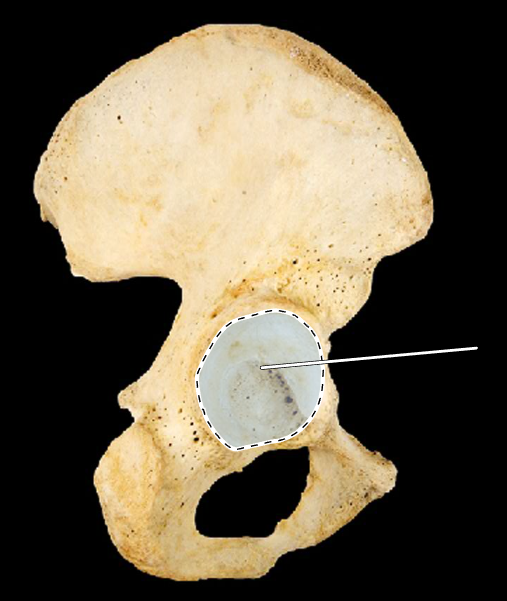 <p>Name the highlighted portion.</p><p>(Hip bone, lateral view, right side).</p>