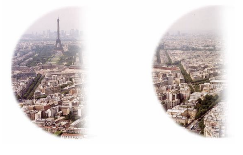 <p><span><span>SAME half of both eyes (e.g., right half of both)</span></span></p><p><span><span>damage: Opposite V1 or optic tract (e.g., left V1 → right hemianopsia); stroke, trauma</span></span></p>