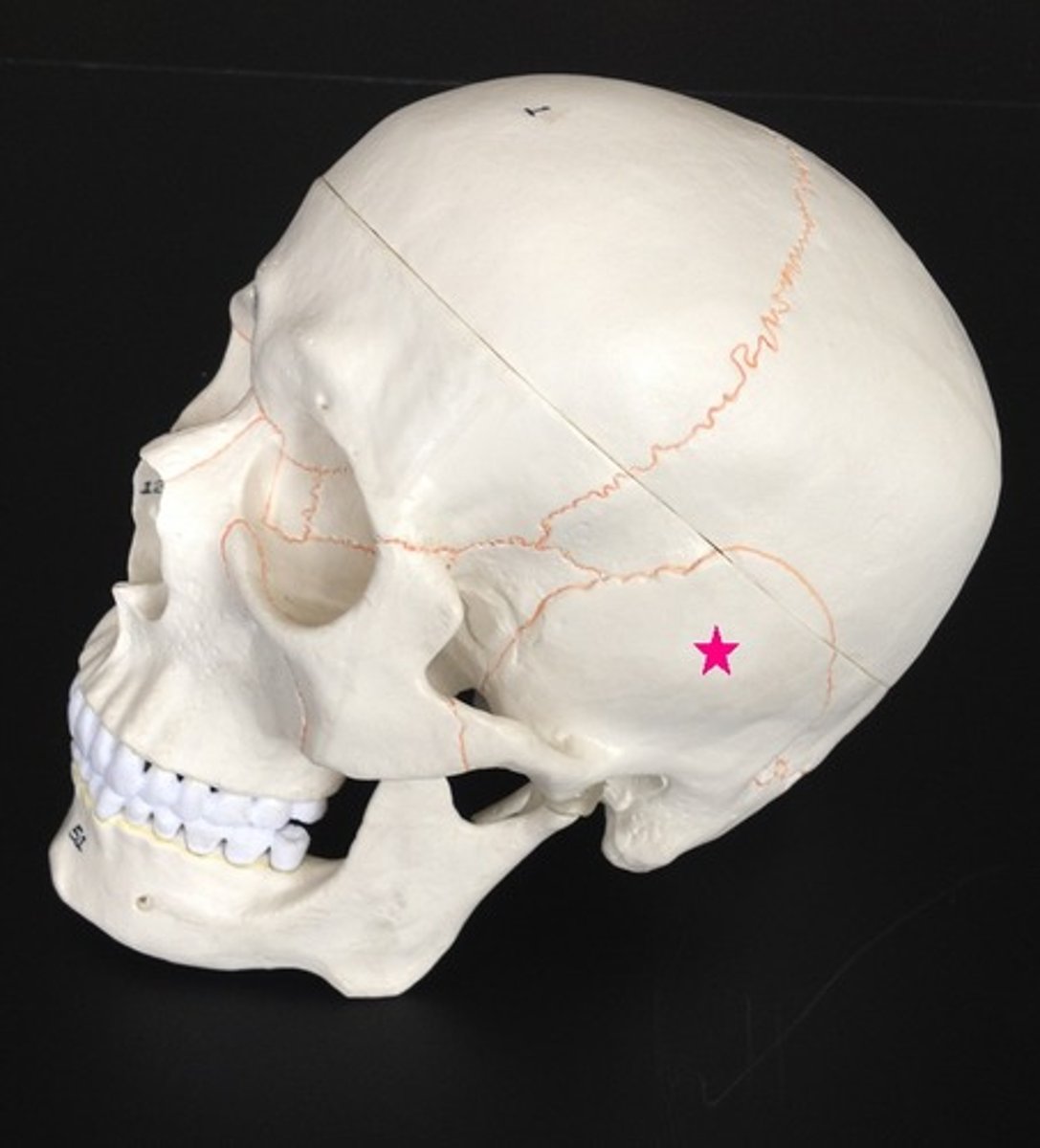 <p>Identify the bone.</p>