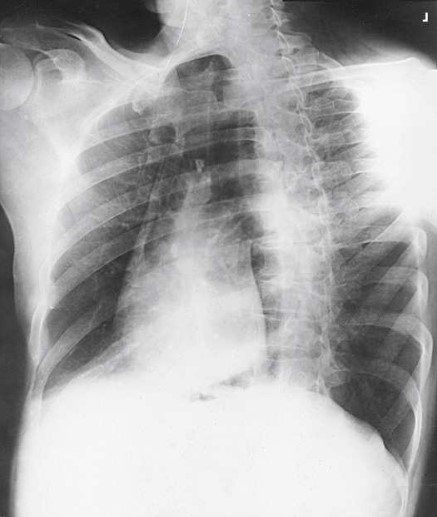 <p>What projection, position and anatomy is shown?</p>