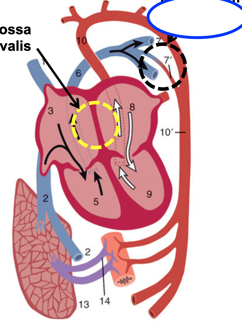 BLACK DOTS- becomes ligamented  when the lungs start functioning again
