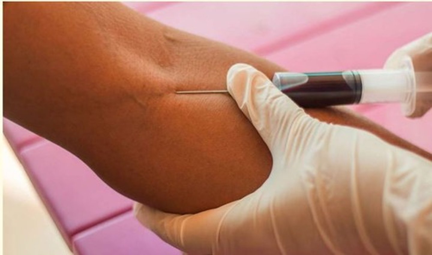 <p>- Venipuncture</p><p>- Blood transfusion</p><p>- Cardiac catheterization</p>