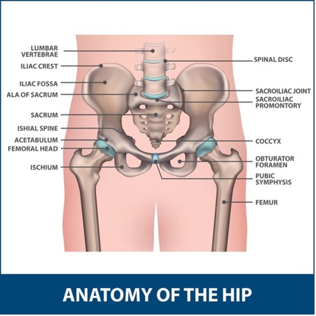 <p>Keeps new hip from popping out</p>