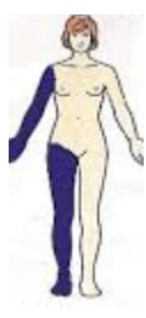 <p>→ same side of the midline </p>