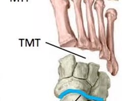 <p><span>proximal interphalangeal joint. the joint between the middle and proximal phalange of a given finger or toe.</span></p>