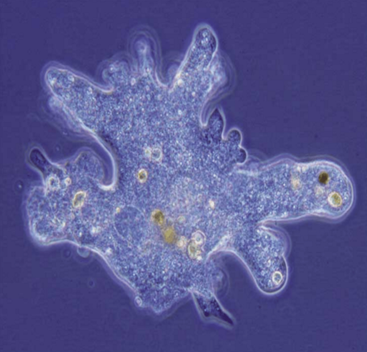 <p>I am unicellular and move around with the help of fingerlike projections called pseudopods.</p><p>I have a nucleus and vacuoles.</p><p>I am common in water and soil.</p><p>I like to eat bacteria and other small organisms.</p>