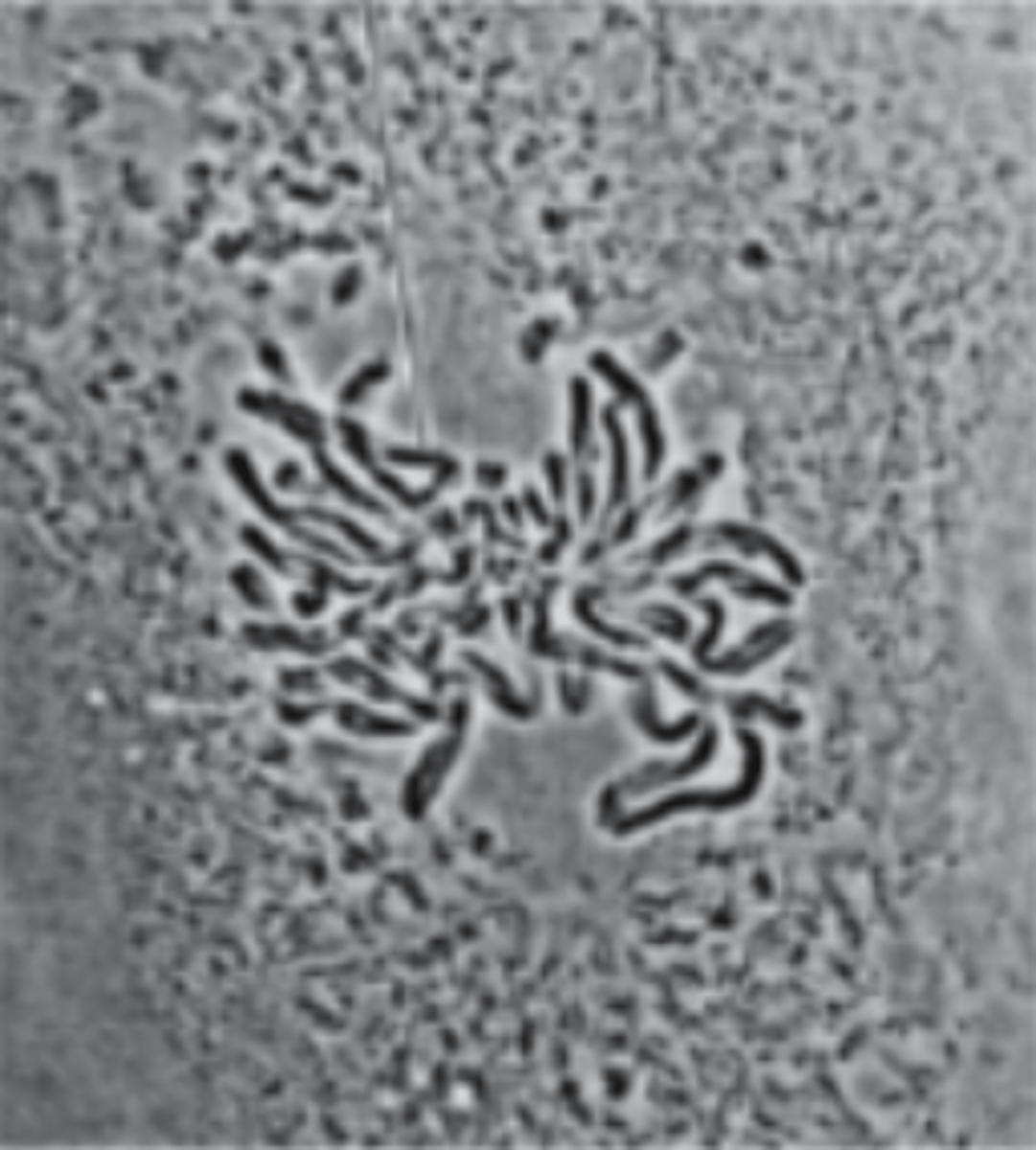 <p>What is happening in preparation for the chromosomes to move into position for cell division?</p>