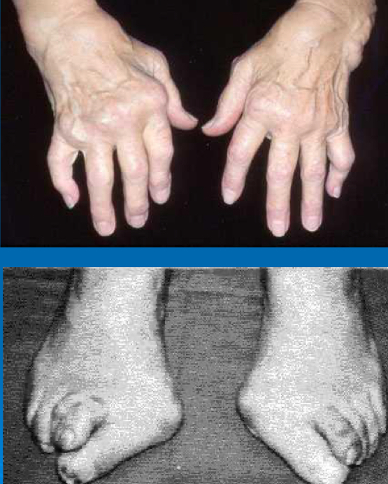 <p>What are these signs of?</p>